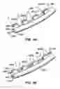 Fig. 22 - Lumen filtering methods