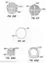 Fig. 30 - Lumen filtering methods