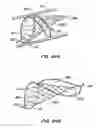 Fig. 31 - Lumen filtering methods