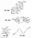 Fig. 49 - Lumen filtering methods