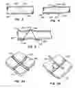 Fig. 04 - Methods for maintaining a filtering device within a lumen