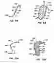 Fig. 08 - Methods for maintaining a filtering device within a lumen