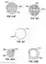Fig. 30 - Methods for maintaining a filtering device within a lumen