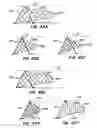 Fig. 32 - Methods for maintaining a filtering device within a lumen
