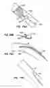 Fig. 40 - Methods for maintaining a filtering device within a lumen