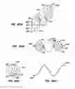 Fig. 49 - Methods for maintaining a filtering device within a lumen