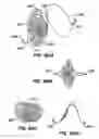 Fig. 50 - Methods for maintaining a filtering device within a lumen