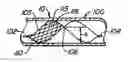 Fig. 01 - Retrievable endoluminal filter