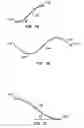 Fig. 06 - Retrievable endoluminal filter
