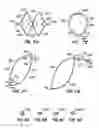 Fig. 07 - Retrievable endoluminal filter