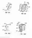 Fig. 08 - Retrievable endoluminal filter