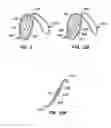 Fig. 09 - Retrievable endoluminal filter
