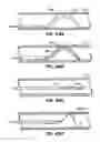 Fig. 35 - Retrievable endoluminal filter