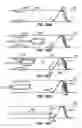 Fig. 43 - Retrievable endoluminal filter