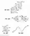 Fig. 49 - Retrievable endoluminal filter