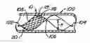 Fig. 01 - Filter delivery methods