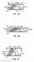 Fig. 03 - Filter delivery methods