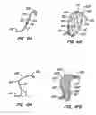 Fig. 08 - Filter delivery methods