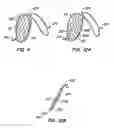 Fig. 09 - Filter delivery methods