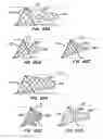 Fig. 32 - Filter delivery methods