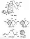 Fig. 47 - Filter delivery methods