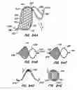 Fig. 48 - Filter delivery methods