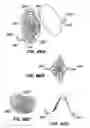 Fig. 50 - Filter delivery methods