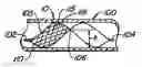 Fig. 01 - Coated endoluminal filter