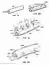 Fig. 46 - Coated endoluminal filter