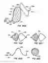 Fig. 47 - Coated endoluminal filter