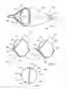 Fig. 02 - Support frame for an embolic protection device