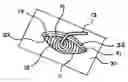 Fig. 01 - Viscera retainers, surgical drains and methods for using same