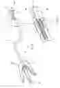 Fig. 05 - Apparatus and method for resectioning gastro-esophageal tissue