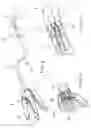Fig. 07 - Apparatus and method for resectioning gastro-esophageal tissue