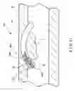 Fig. 08 - Apparatus and method for resectioning gastro-esophageal tissue