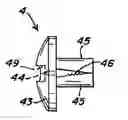 Fig. 01 - Suture fixation device and method for surgical repair