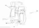Fig. 01 - Cardiac pacemaker having a sealed oblong housing