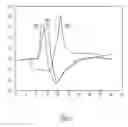 Fig. 03 - Morphology-based optimization of cardiac resynchronization therapy