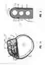 Fig. 02 - Electrode for a pulse generator and method therefor