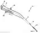 Fig. 01 - Insertion device for an electrode array