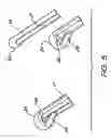 Fig. 06 - Insertion device for an electrode array