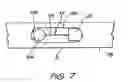 Fig. 09 - Insertion device for an electrode array