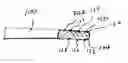 Fig. 01 - Atrial pacing lead