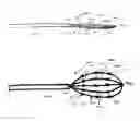 Fig. 05 - Atrial pacing lead
