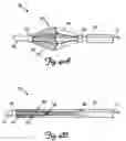 Fig. 06 - Self-deploying vascular occlusion device