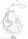Fig. 02 - Cardiac lead having self-expanding fixation features