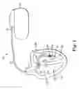Fig. 02 - Fixation device for coronary venous lead