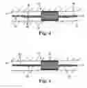 Fig. 04 - Fixation device for coronary venous lead