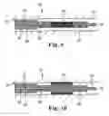 Fig. 07 - Fixation device for coronary venous lead