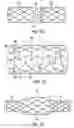 Fig. 06 - Device comprising biodegradable bistable or multistable cells and methods of use